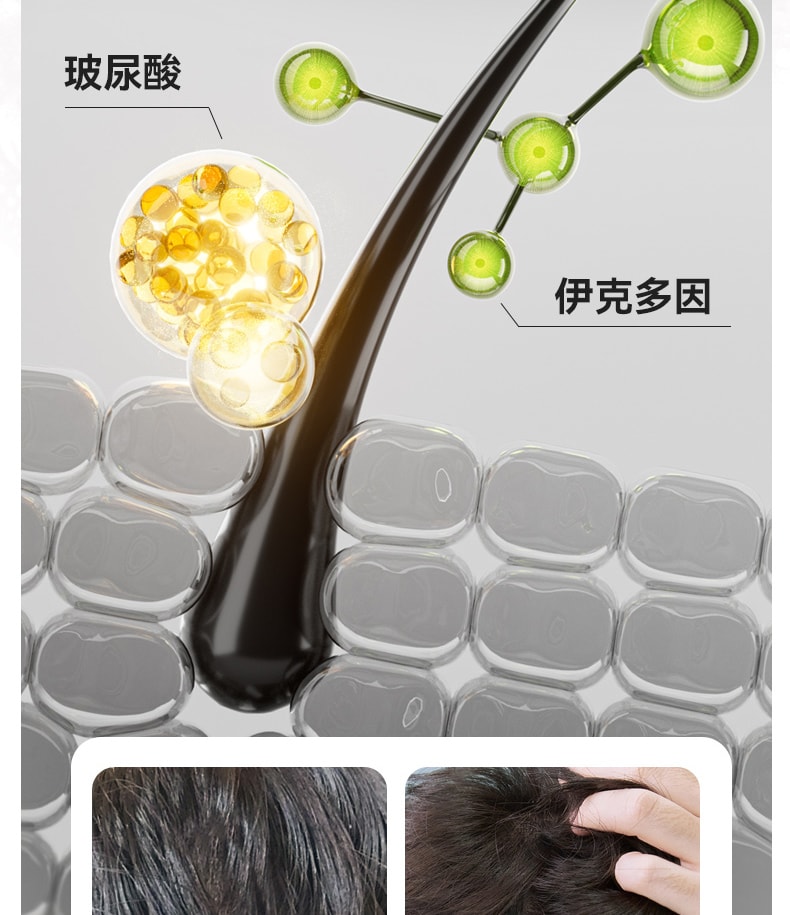 【中國直郵】 和草集 小藍瓶止癢去屑二硫化硒洗髮水 平衡頭皮微生態 淨屑止癢不反复 鳶尾誘惑香型 300ml/瓶