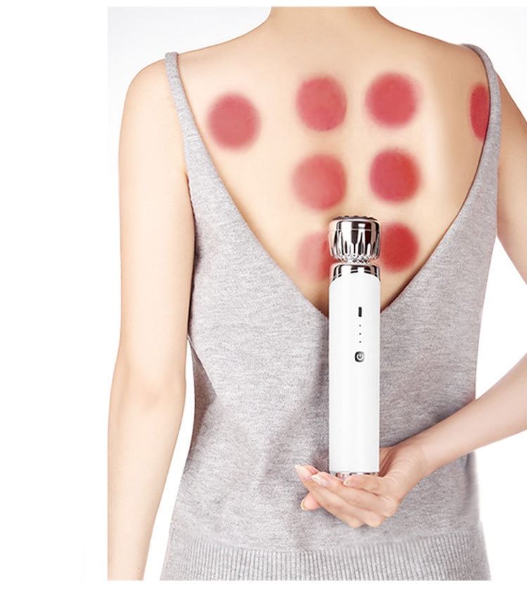 【中國直郵】 晶雅家 經絡舒養 3 合 1 電動拔罐器 砭石艾灸 + 刮痧 贈 4 罐 + 30 粒艾柱 白色套裝