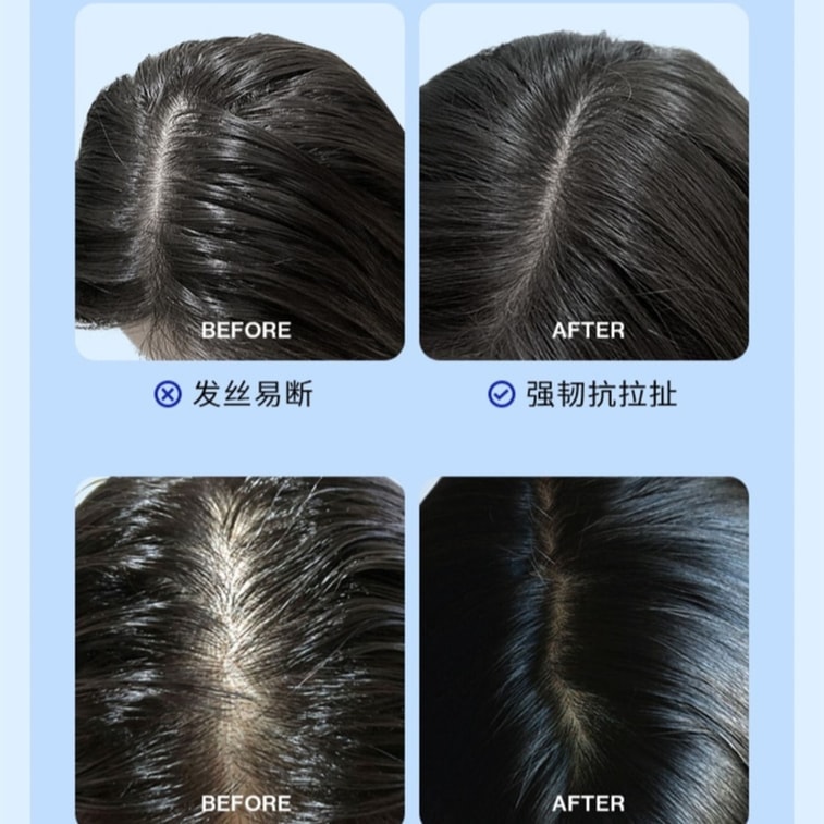 Anti-hair loss, Anti-breakage and Hair Stabilization shampoo, 500ml per bottle