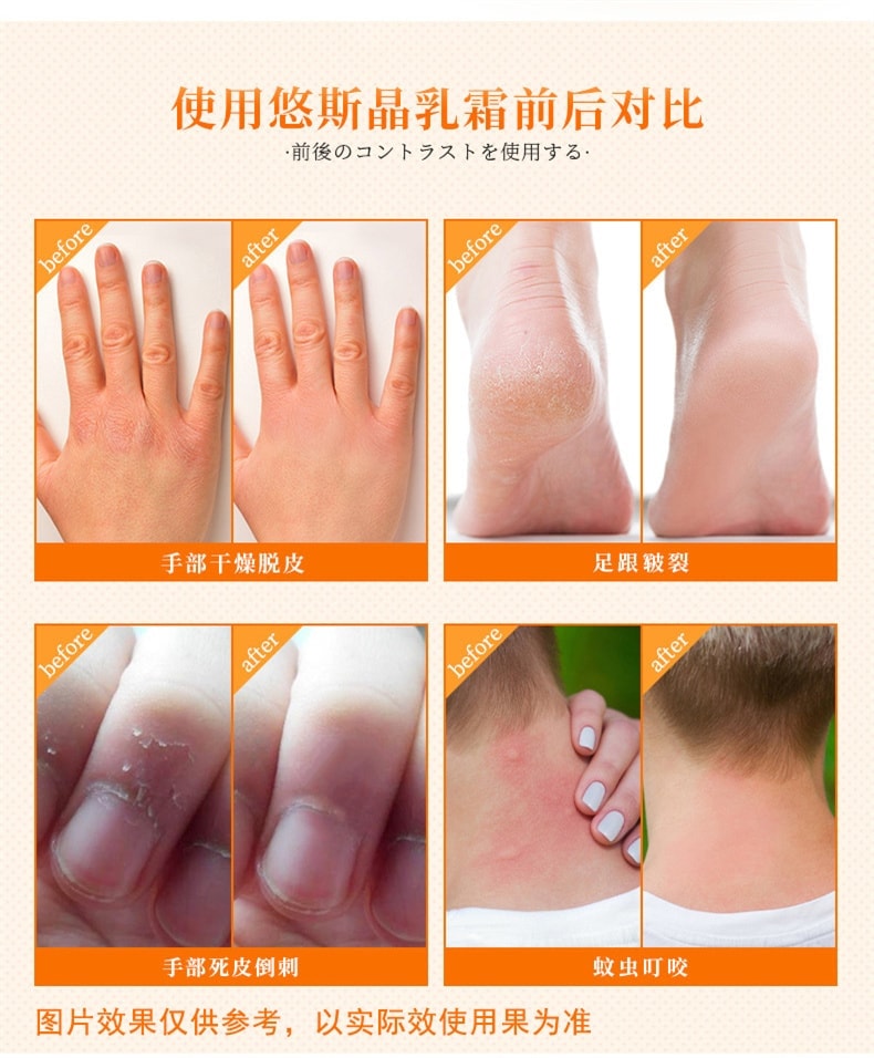  日本 悠斯晶 維生素乳霜 防乾裂 滋潤保濕 護手霜 圖案包裝隨機發 40g