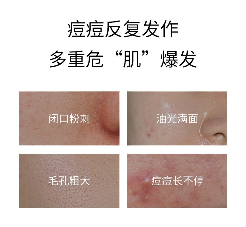 【中国直邮】 稚漾 壬二酸净颜凝露水杨酸细致毛孔霜去黑头紧致毛孔 净颜凝露30g+毛孔细致霜30g