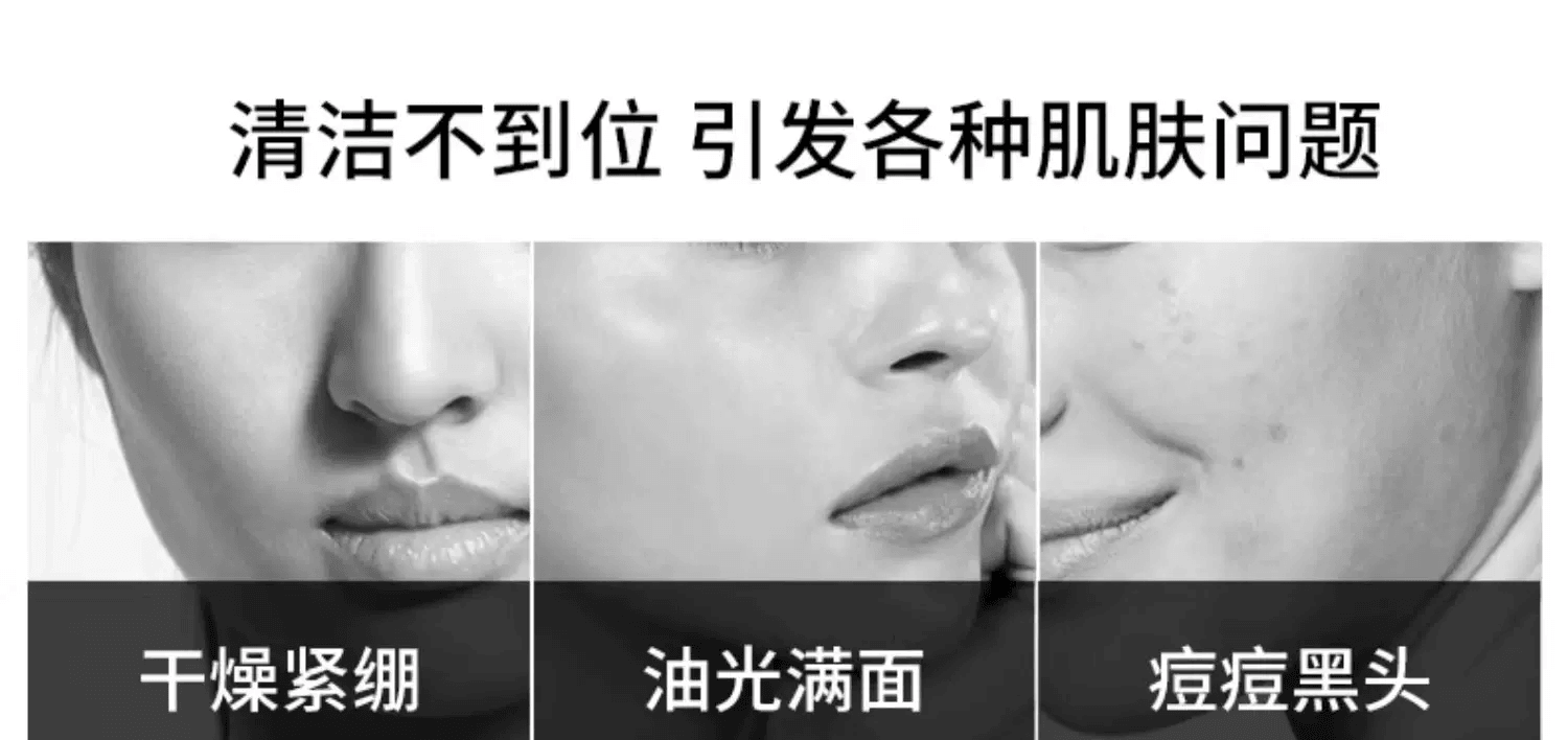頤蓮 福瑞達氨基酸淨爽洗面奶100g 【敏感肌痘肌放心用】泡沫細膩 深層清潔 水潤不緊繃雙重氨基酸潔面乳