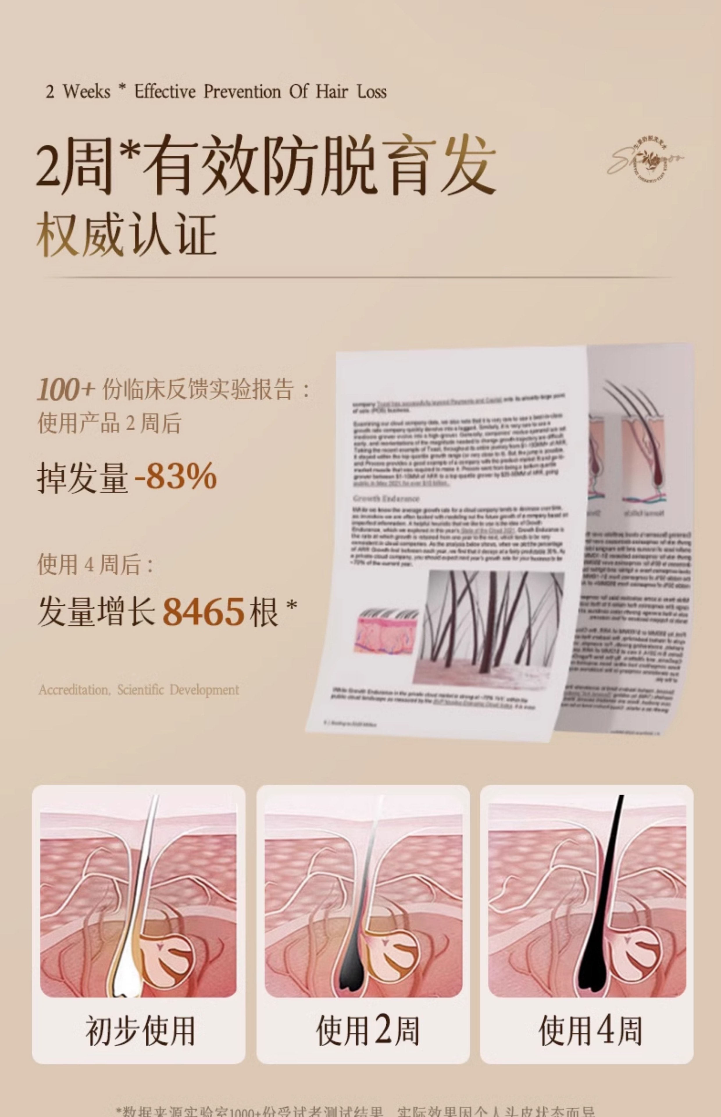 【中国直邮】 新加坡 Kuvive 防脱洗发水 长发育发控油蓬松去屑咖啡因生姜固发脱发洗头膏露 500ml/瓶