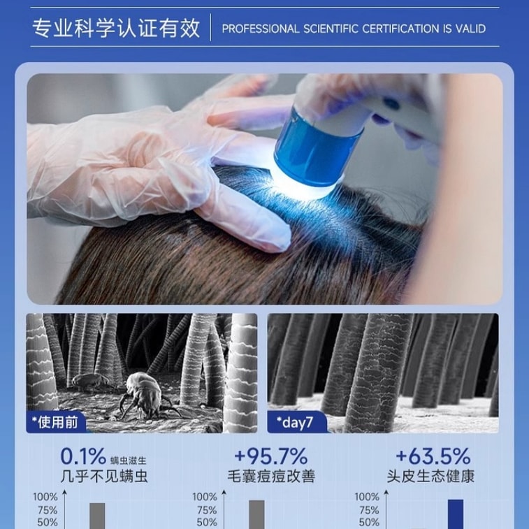 [중국 직배송] 노화 방지 셀레늄 설파이드 샴푸, 액상형, 유분 조절, 볼륨감 부여, 비듬 제거, 가려움 방지, 두피 모낭 세정, 진드기 제거, 항염 효과 (남녀 공용), 300ml 3