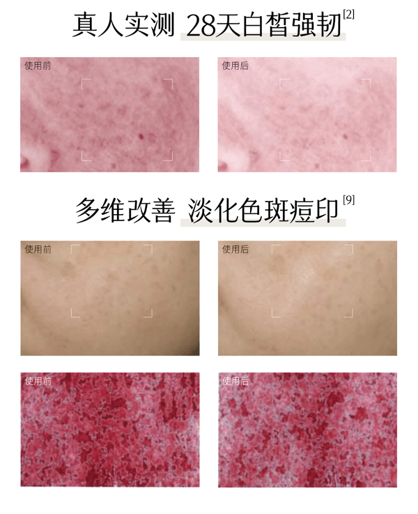  谷雨 【皇牌-经典水乳霜组合】第三代光感水乳霜套装  【美白快准狠】【稳白不反黑】【更适合亚裔肤质】减黄提亮 美白淡斑 修护(光感水150ml+光感乳100ml+美白奶罐50g)