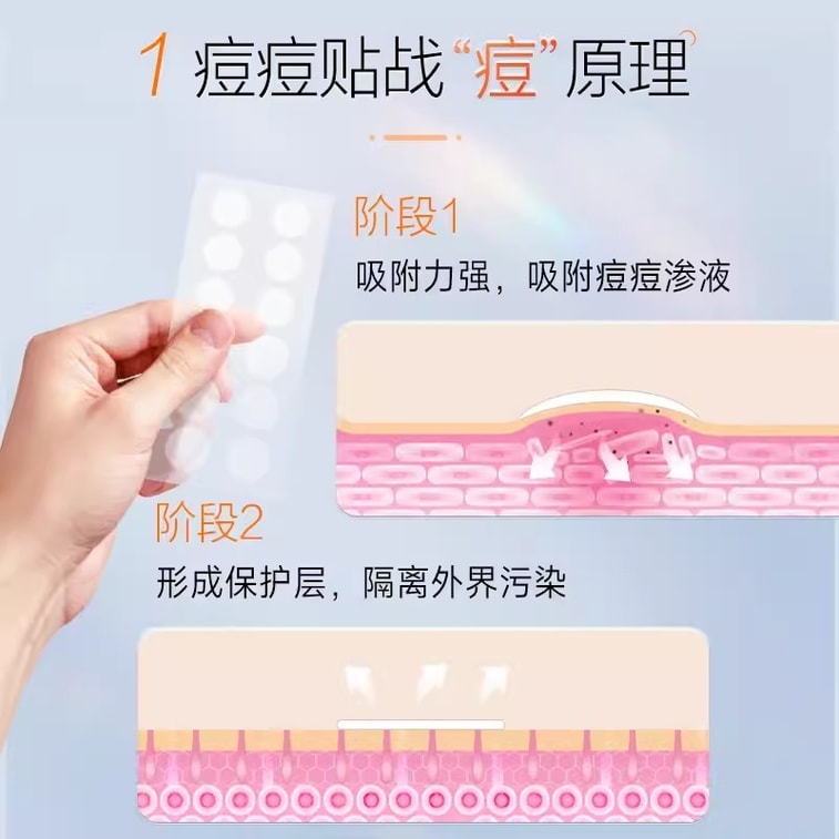 [중국 직배송] 피엔쯔황 여드름 패치, 여드름 치료 패치, 여드름 마스크형 드레싱, 여드름 제거 패치, 12개입 3