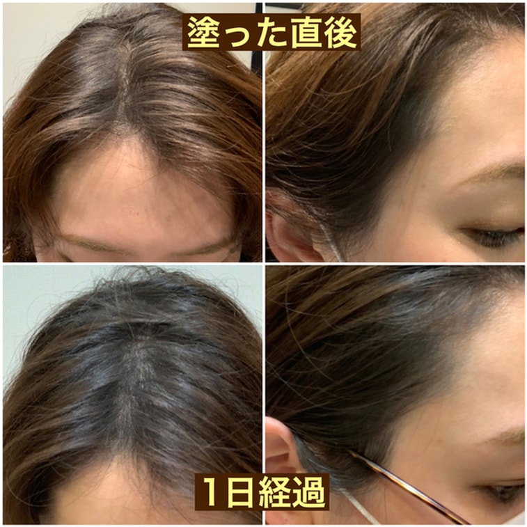 【日本直邮】日本FUJIKO 发际线阴影粉 4g 发际线填充神器 5