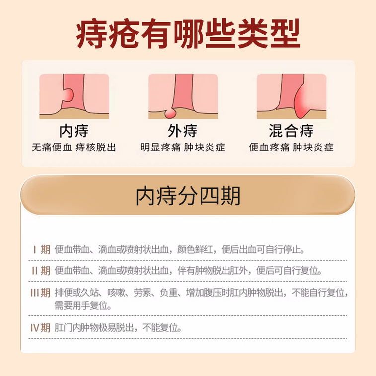 마잉룽 [중국산 정품] 사향 치질 연고 항문 출혈 치질약 부기 완화 통증 완화 혹 제거 탈항 항문 가려움 항문 통증 복합 치질 10g*1개 4
