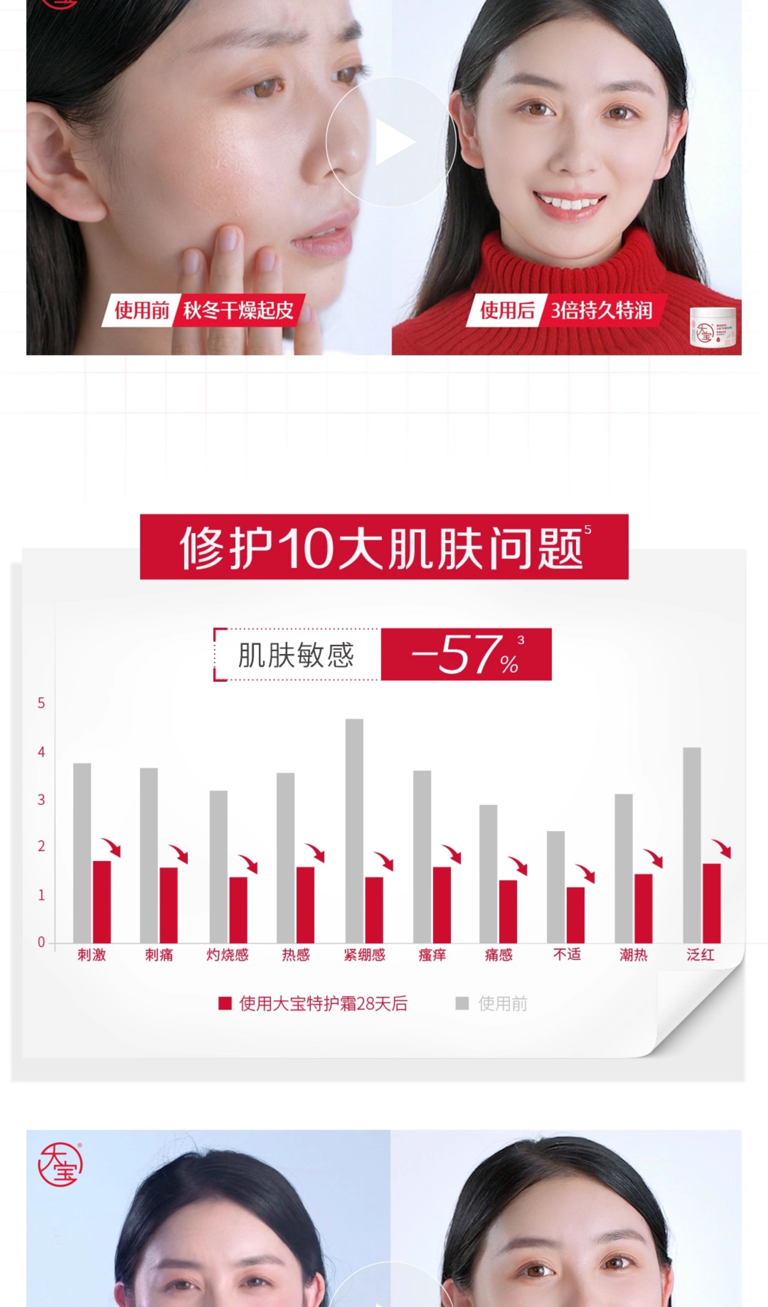 【中国直邮】 大宝 维他命B5面霜 安敏舒缓特护霜 保湿修护【李佳琦强推必入】70g*1罐