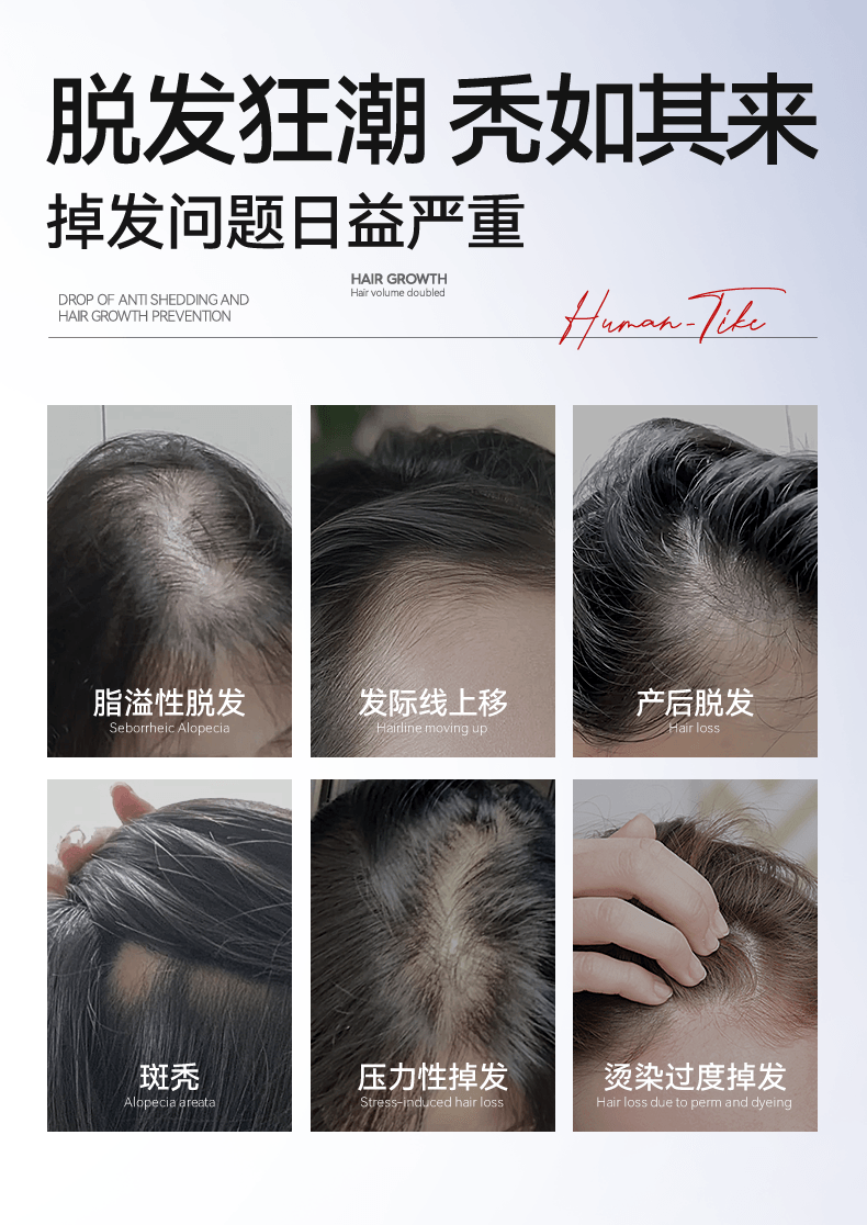 【中国直邮】 新加坡 Kuvive 生姜育发液 生长发增发密发头皮精华液头发护理剂发际线快速长 100ml/瓶