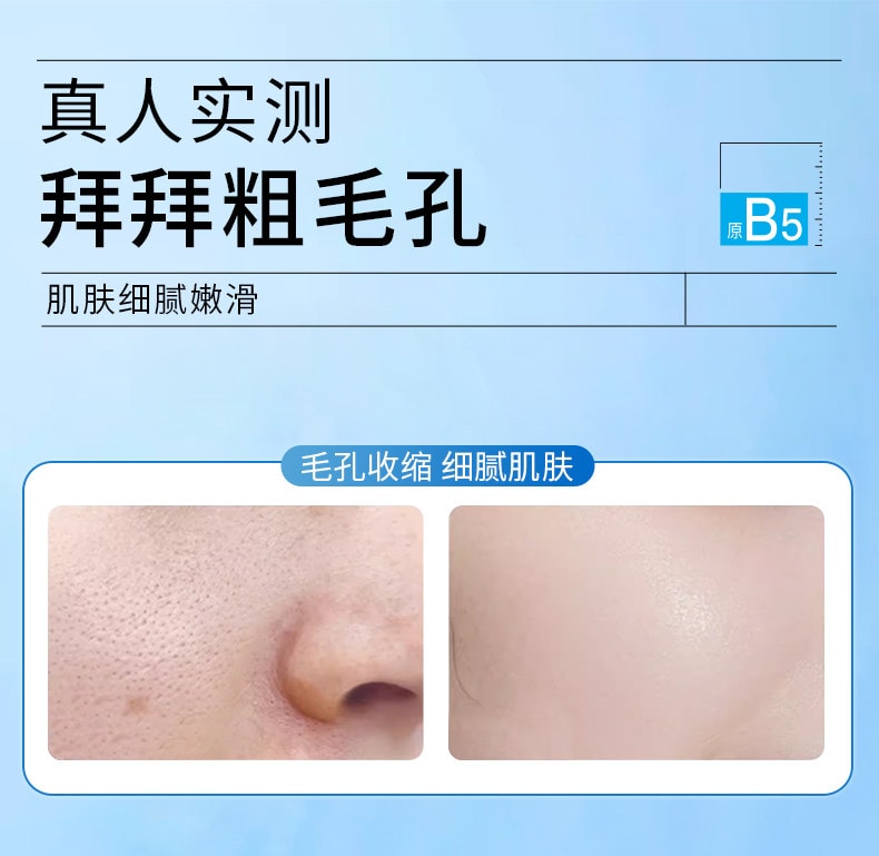 臻羞 B5毛孔收縮精華液32ml/瓶 毛孔收縮補水保濕去黑頭粉刺閉口面部爽膚水男女