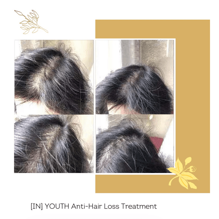 【歐洲直郵】 法國 馥洛薇 小橙針 止脫育發角蛋白 10支/盒 3