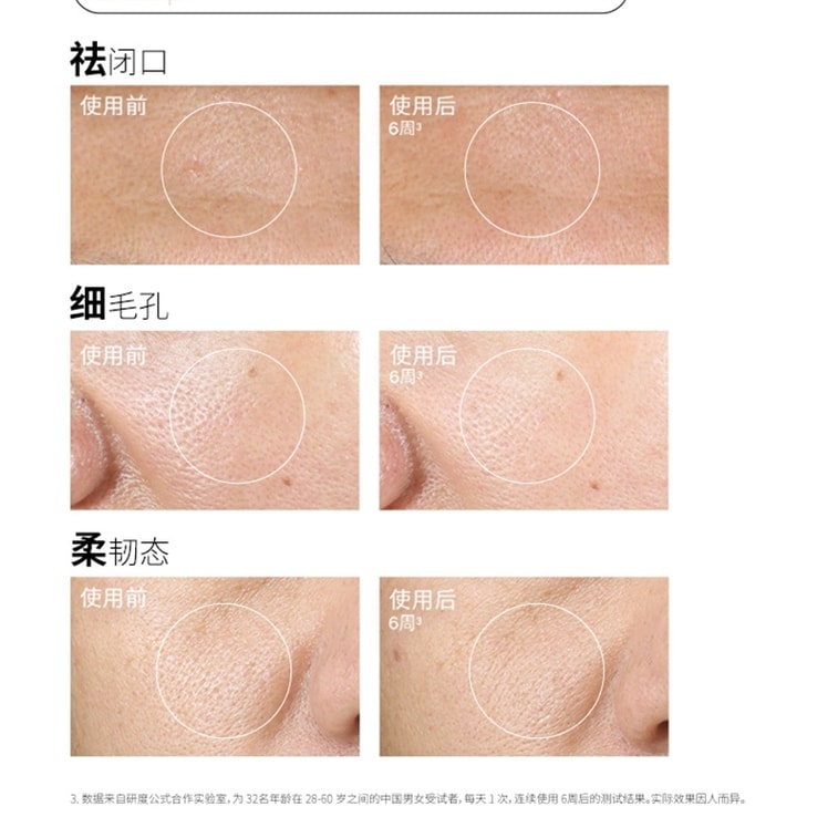 5% Glycolic Acid Toner – Exfoliates And Treats Congested Pores (240ml) 4