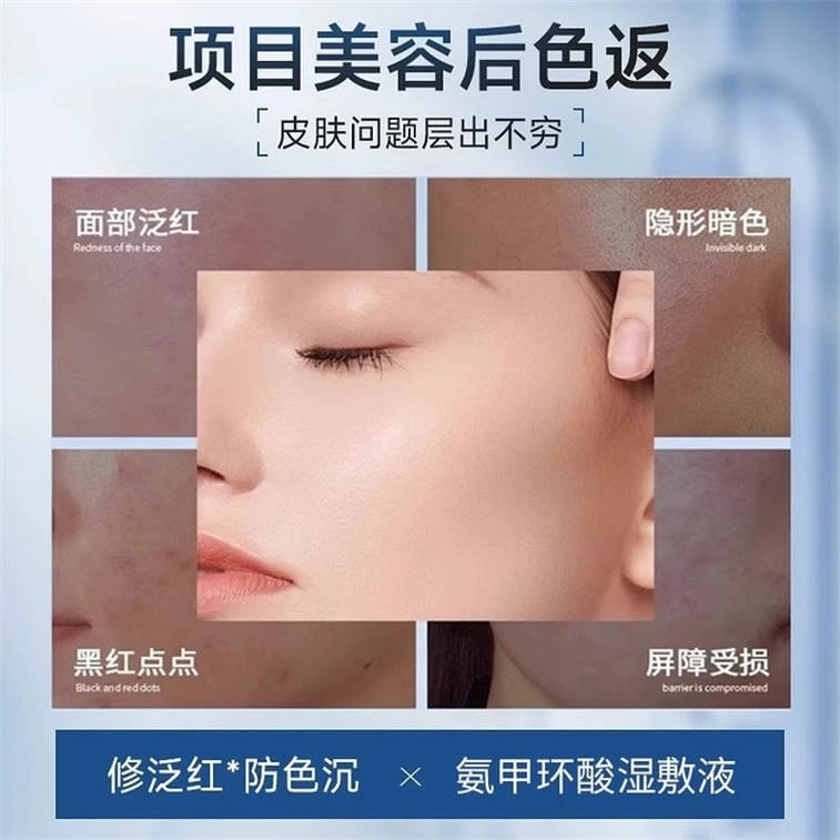 【中国からの直送】アンチエイジングトラネキサム酸エッセンス トラネキサム酸ウェットコンプレックス 黄ばみ除去、明るくする、毛穴を引き締める、修復、鎮静 100ml 3