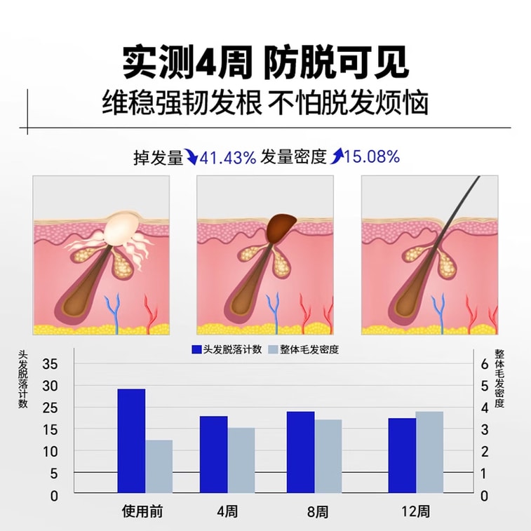 EHD 防脫防斷固髮洗髮精500ML含去屑防脫髮洗髮水100ml*2+淨澈防脫固髮精華液20ml 超強豪華禮盒套組 深層清潔防斷固髮修養頭皮組合裝7d 20ML送禮禮品 3