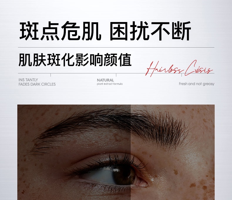 【中国直邮】 新加坡 Kuvive 焕白净斑霜 377祛黄褐斑面霜 美淡化色斑去老年斑雀斑白保湿滋润 30g/瓶