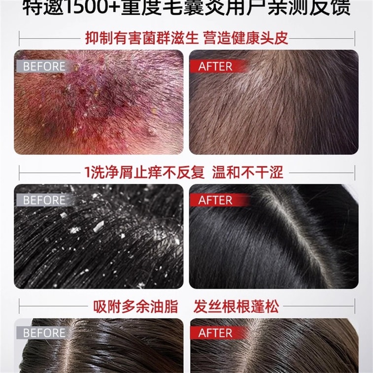 【中国直邮】 新加坡 Kuvive 毛囊净澈洗发水 二硫化硒洗发水毛囊除炎螨去屑止痒控油蓬松洗头膏露男女正品 500ml/瓶 3