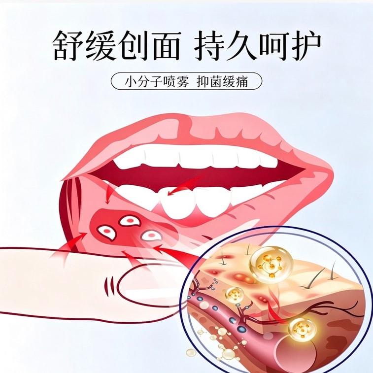 南京同仁堂 醫用重組膠原蛋白口腔黏膜敷料 口腔潰瘍炎症修復噴霧劑 50ml/瓶 3