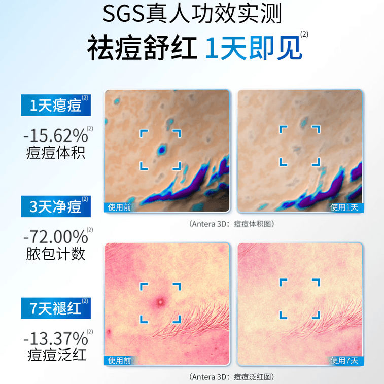 Acne Patches 36pcs - Invisible Hydrocolloid Pimple Patches, Absorb Exudate & Flatten Zits Overnight, Waterproof & Makeup Friendly 3