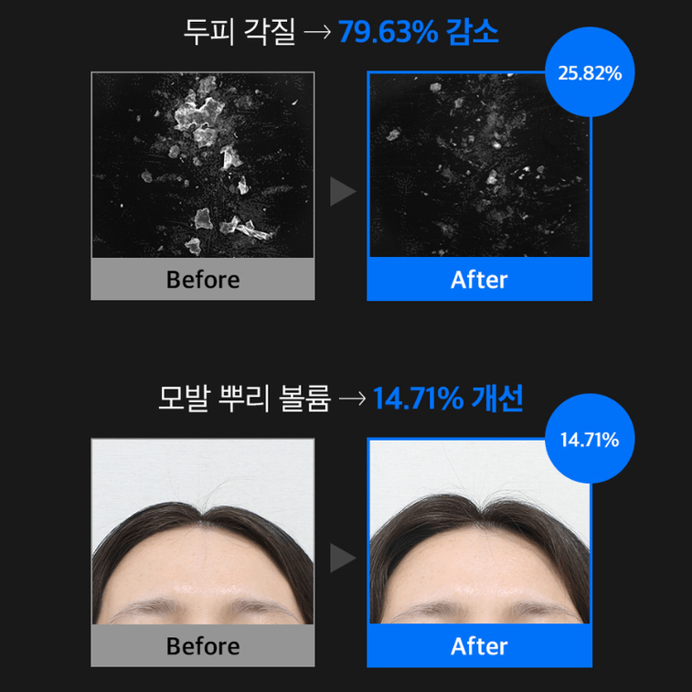 Refilled Anti-Hair Loss Scalp Essence 100ml1bottle 4