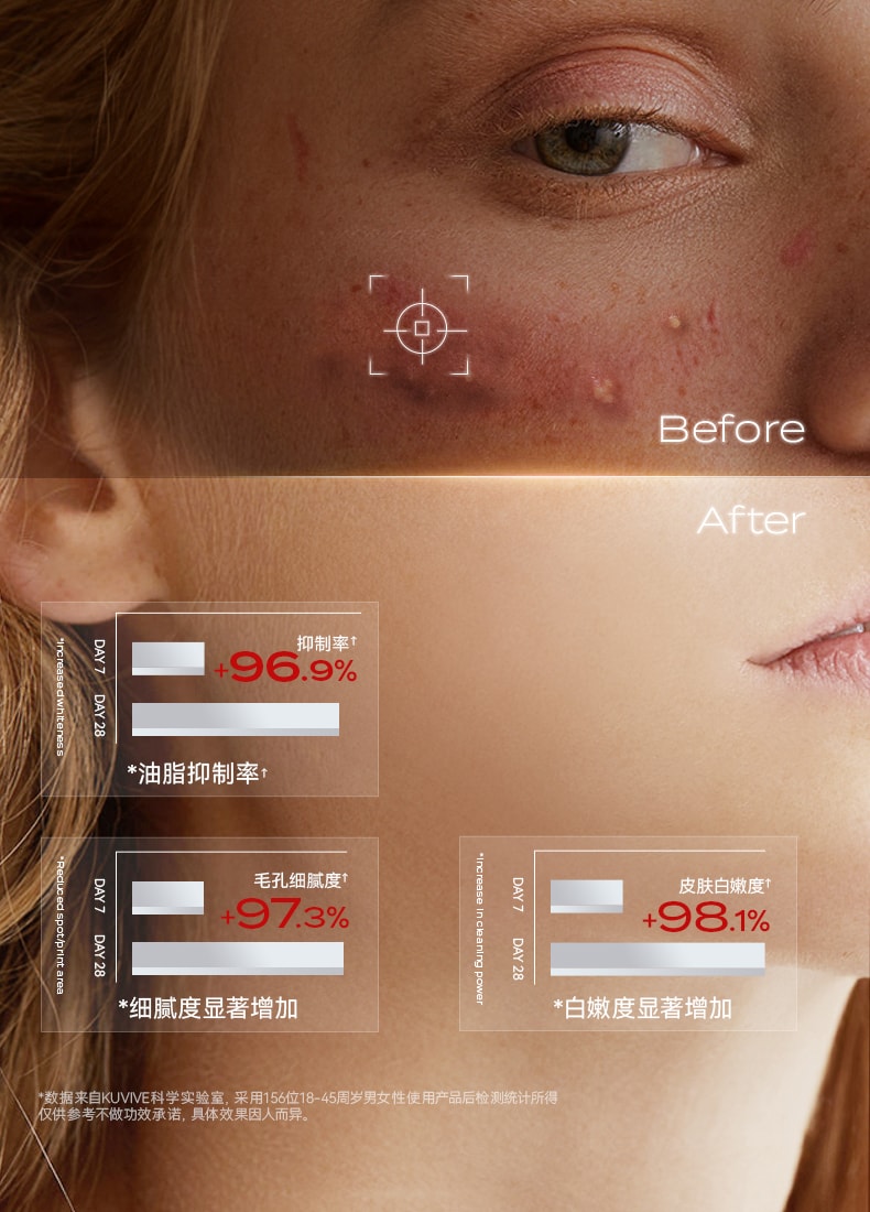 【中国直邮】 新加坡 Kuvive 水杨酸细腻毛孔精华 收缩毛孔精华液 修复粗大面部收敛祛痘印去闭口粉刺敏肌 50ml/瓶