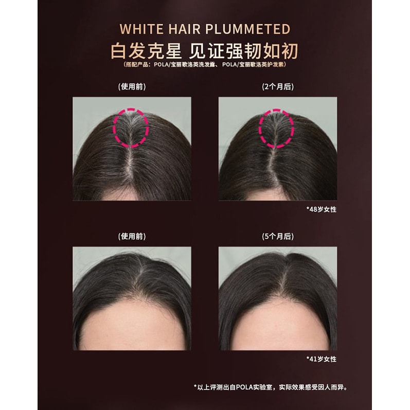 【日本直郵】POLA寶麗 預防掉髮 強髮固發生髮精華液水 BK生髮液 170ml