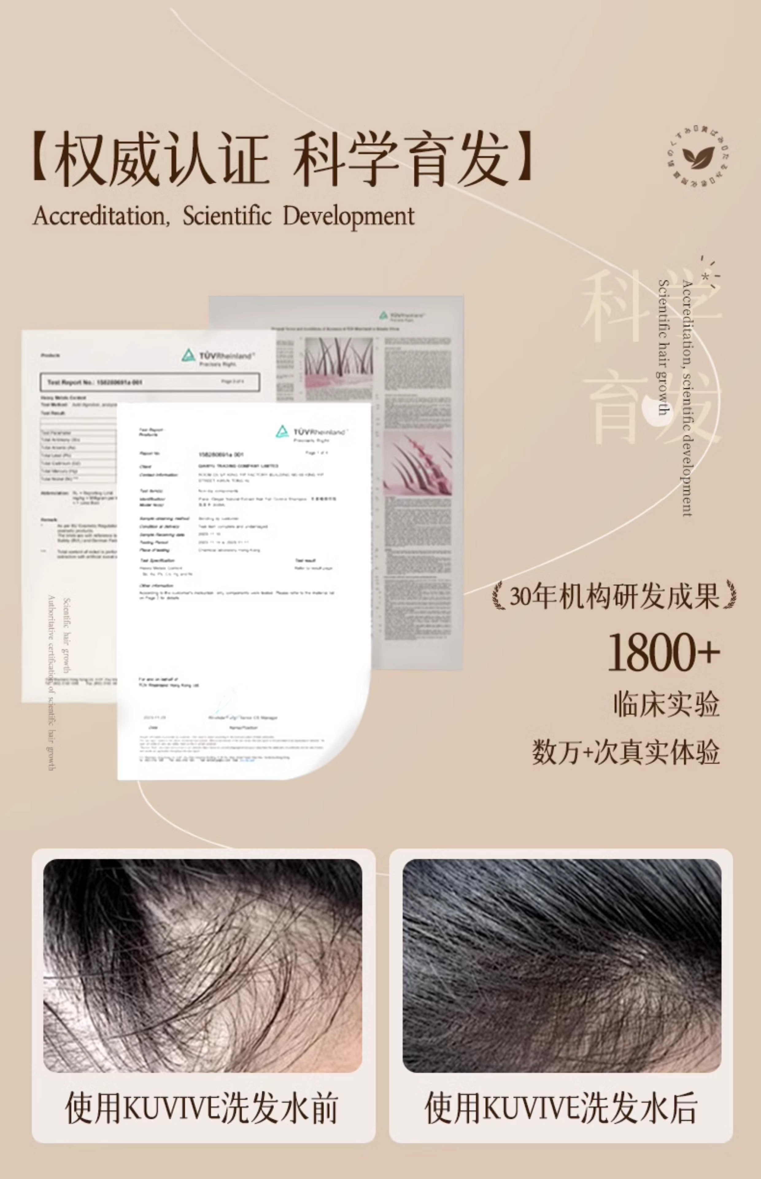 【中国直邮】 新加坡 Kuvive 防脱洗发水 长发育发控油蓬松去屑咖啡因生姜固发脱发洗头膏露 500ml/瓶