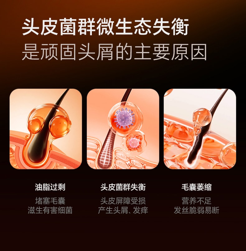 【中国直邮】 和草集 去屑控油洗发水 蓬松止痒改善头皮清爽不油腻 300ml/瓶