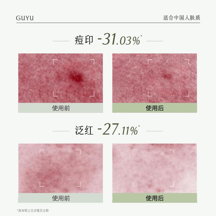 谷雨 【專為油痘肌研發-水乳霜套裝】白千水乳霜套裝【祛痘平閉口】【8小時持效控油】【更適合亞洲人膚質】舒緩修護 補水保濕 收縮毛孔 (細膚爽膚水150ml + 淡印乳液100ml + 控油面霜50g) 4