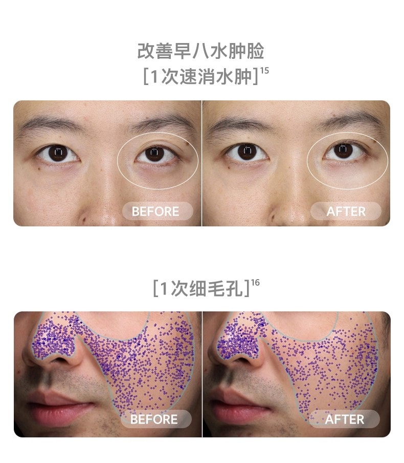 【品牌国内同价】FLOSSOM花至 小紫弹智能射频美容仪器 家用智能美容仪 多功能分区护理 脸部&颈部提拉紧致 速渗透 强透亮FR200 1 件