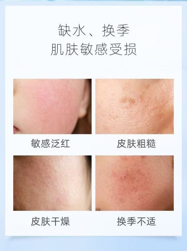 【中国直邮】 敷尔佳 积雪草舒缓修护水 补水保湿 镇静抗敏 120ml 敏感肌适用