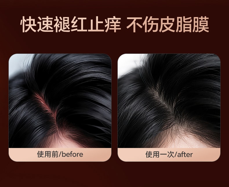 【中国直邮】 和草集 去屑控油洗发水 蓬松止痒改善头皮清爽不油腻 300ml/瓶