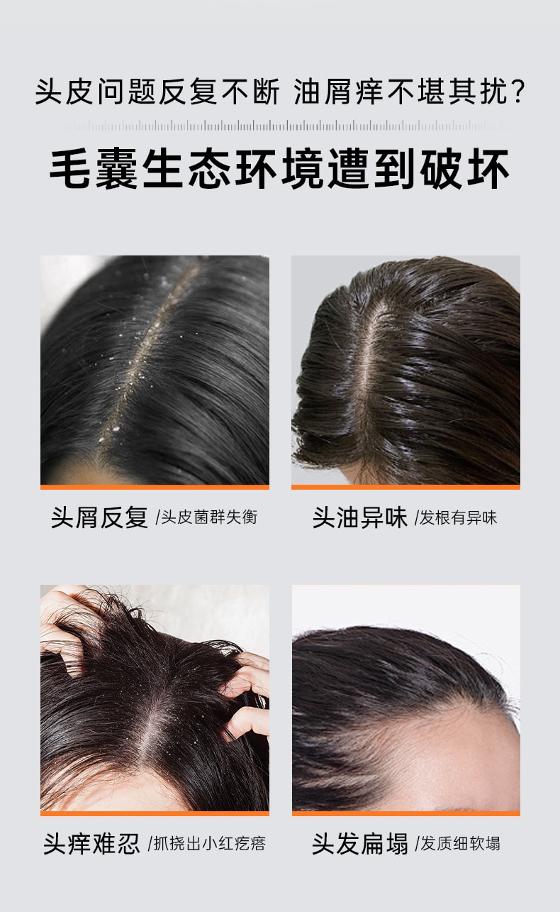 Selenium disulfide shampoo for oil control, fluffiness, dandruff removal and itch relief, salicylic acid shampoo 250ml