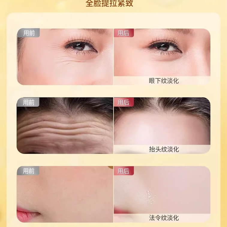 【中国直邮】奢笛熊sdx 法令纹贴提拉紧致弹润淡纹贴洋甘菊舒润额头抬头纹贴男女川字纹贴提拉紧致神器面膜免洗 10对/盒 3