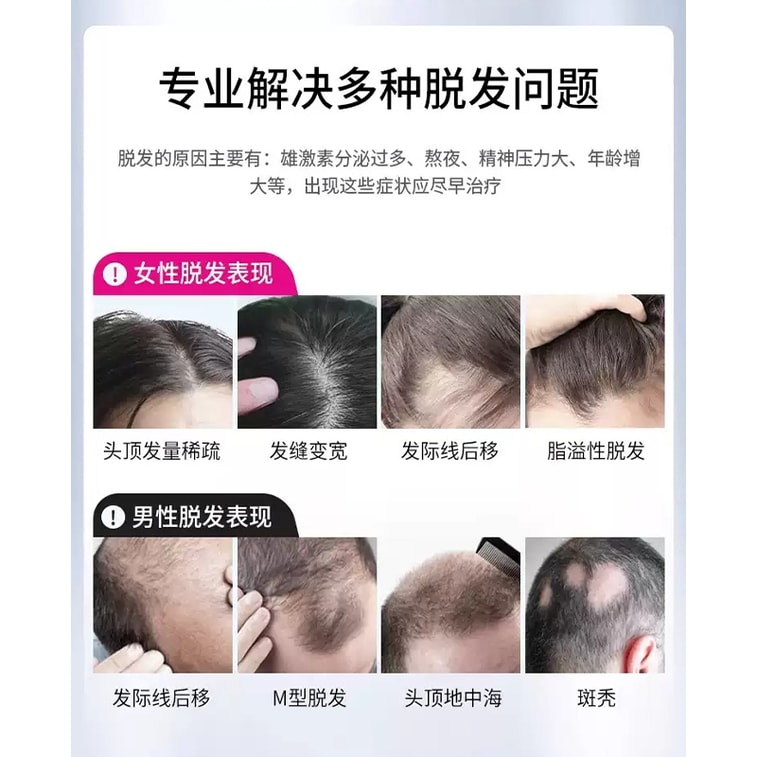 商品詳細 - 【中国直送】大菲鑫ミノキシジルローション 育毛液 抜け毛対策スプレー 60ml×6箱【男性用 増毛 固形パック 6ヶ月分】 - 画像3