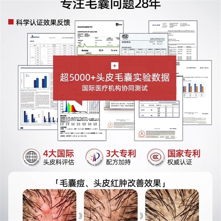 【中国直邮】 新加坡 Kuvive 毛囊净澈洗发水 二硫化硒洗发水毛囊除炎螨去屑止痒控油蓬松洗头膏露男女正品 500ml/瓶 5