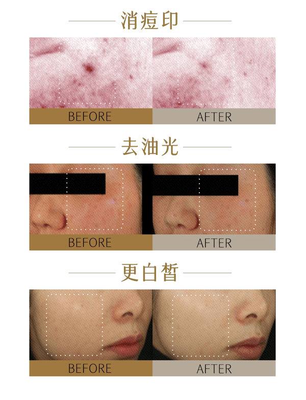 穀雨 【性價比夯爆-美白囤裝2瓶】實驗室淨白瓶【淡斑專研】【28天精準淡斑】 光蘊淡斑煥白精華液【細胞ATP科技】 美白精華 修護保濕【娜扎代言】25ml/瓶