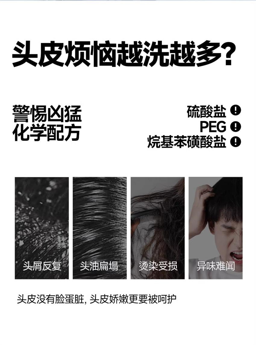 【中国直邮】 oiu 男士控油去屑洗发露 男士去屑洗发水控油蓬松止痒舒缓头皮无硅油 300ml/瓶