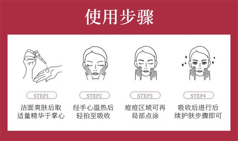 臻羞 果酸水楊酸收縮毛孔粗大修復護精華液刷面部酸淡化祛黑頭閉口粉刺 溫和剝脫老廢角質,疏通毛孔,改善閉口、粉刺、痘痘與粗糙膚質30ml