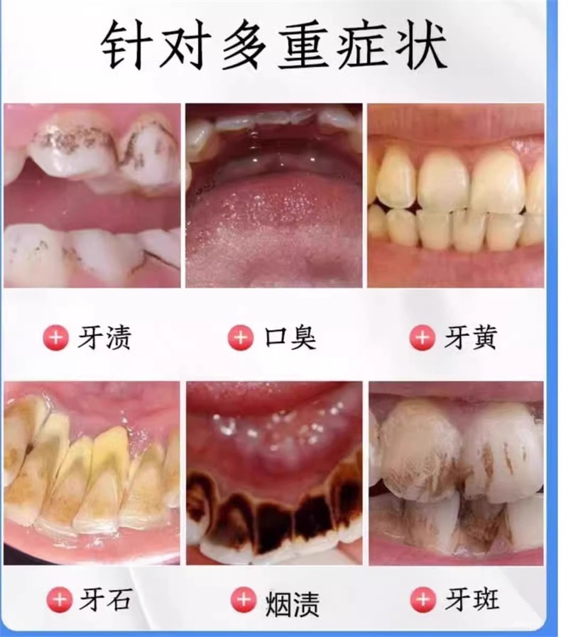 【中国直邮】仁和匠心 酵素牙膏美去白黄口臭成人洗白神器官方正品女男士专用 100g