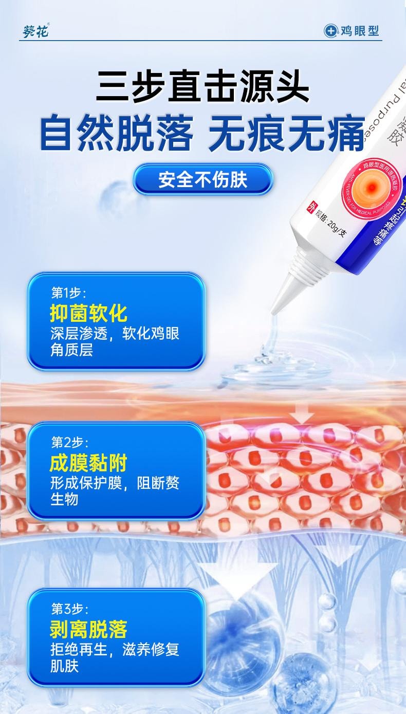 【中国直邮】 葵花药业 鸡眼型 医用退热凝胶 去脚上手上鸡眼脚底老茧肉刺瘊子脚钉鸡眼膏 20g/盒