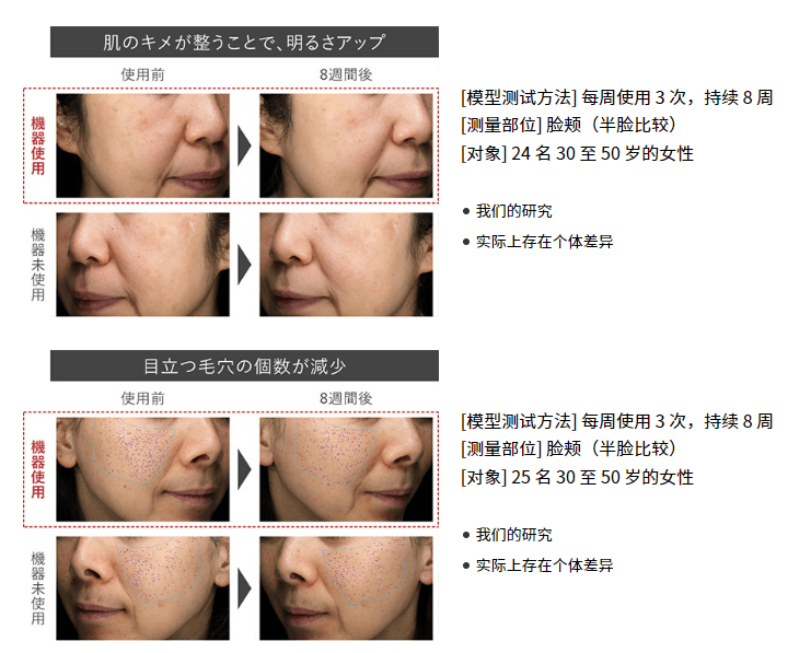 【日本直邮】日本PANASONIC 松下 整肌美容仪 EH-SL85