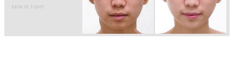 【中国直邮】卡蕾兰 RF射频美容家用脸部导入仪器面部洁面光子嫩肤提拉紧致童颜机去法令纹神器 紫色