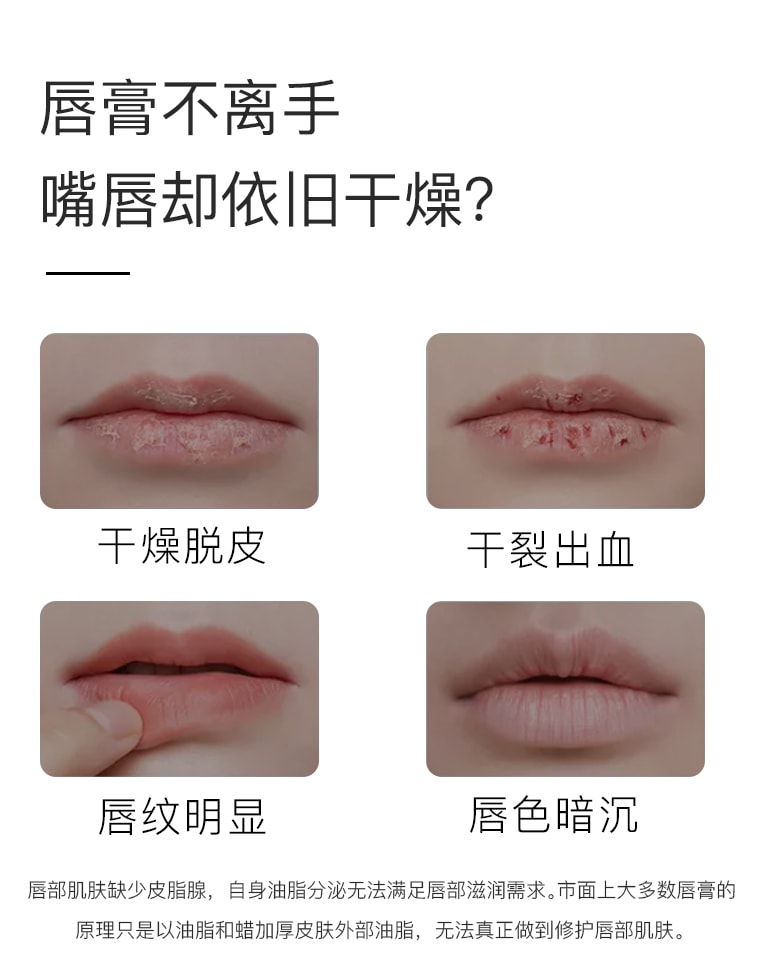 【日本直邮】日本  PLIFT  淡化唇纹 唇部精华美容液6ml