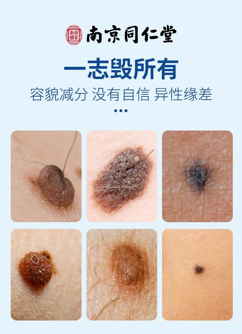 【中国直邮】南京同仁堂 新品 点志宁套装5ml+5g 祛痣无痛不留痕