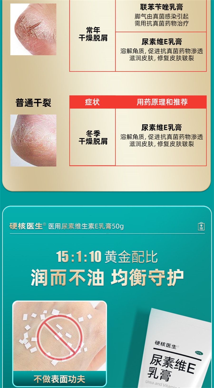 【中國直郵】 硬核醫師 尿素維E乳膏 維e乳軟膏外塗去黑色素尿酸尿囊素護手霜50g/支