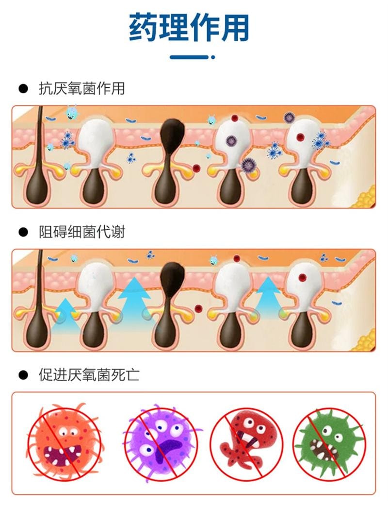 【中國直郵】 仁和 甲硝唑凝膠祛痘膏去黑頭修補消炎甲硝銼凝膠壬二酸紅黴素軟膏 30g /支