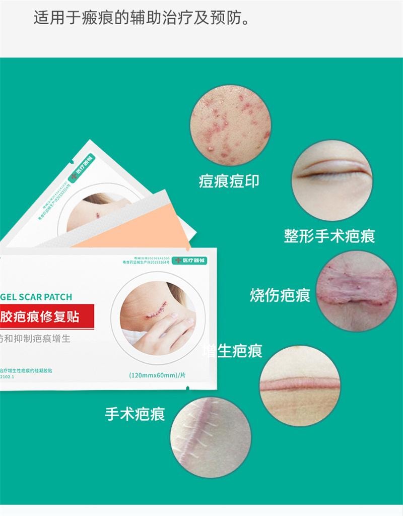【中國直郵】 舒奈美 矽凝膠疤痕敷料修護貼矽酮傷疤痘印遮瑕貼膚色防水透氣 3片裝/盒