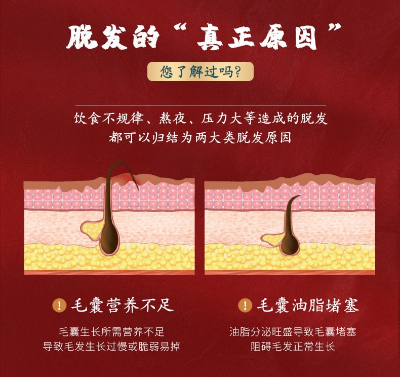 【中國直郵】南京同仁堂 何首烏生薑洗髮精 止癢去屑 清爽控油密發500ml/瓶