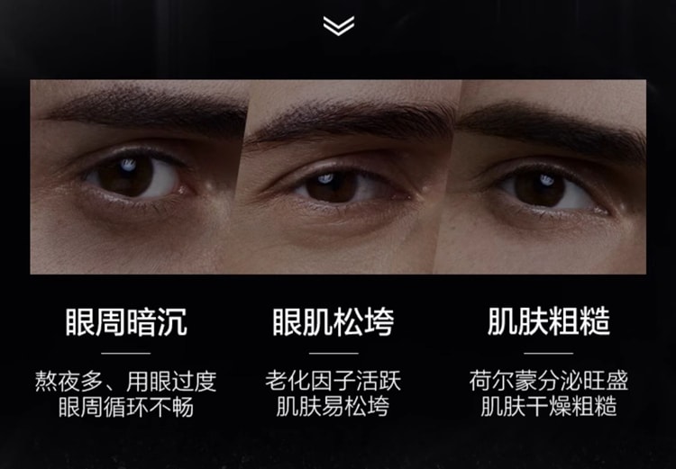 【日本直邮】日本 SHISEIDO 资生堂 男士 塑形眼周 眼光更出采 焕能眼霜 15ml